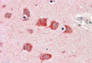 IHC - Goat Anti-DKK3 / REIC Antibody AF1325a